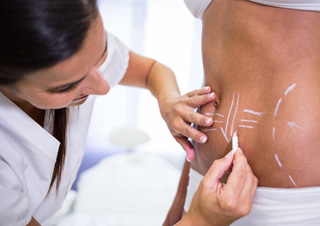 Lipo C (Weight Loss) ($69)